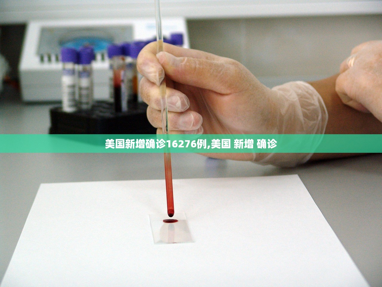 美国新增确诊16276例,美国 新增 确诊